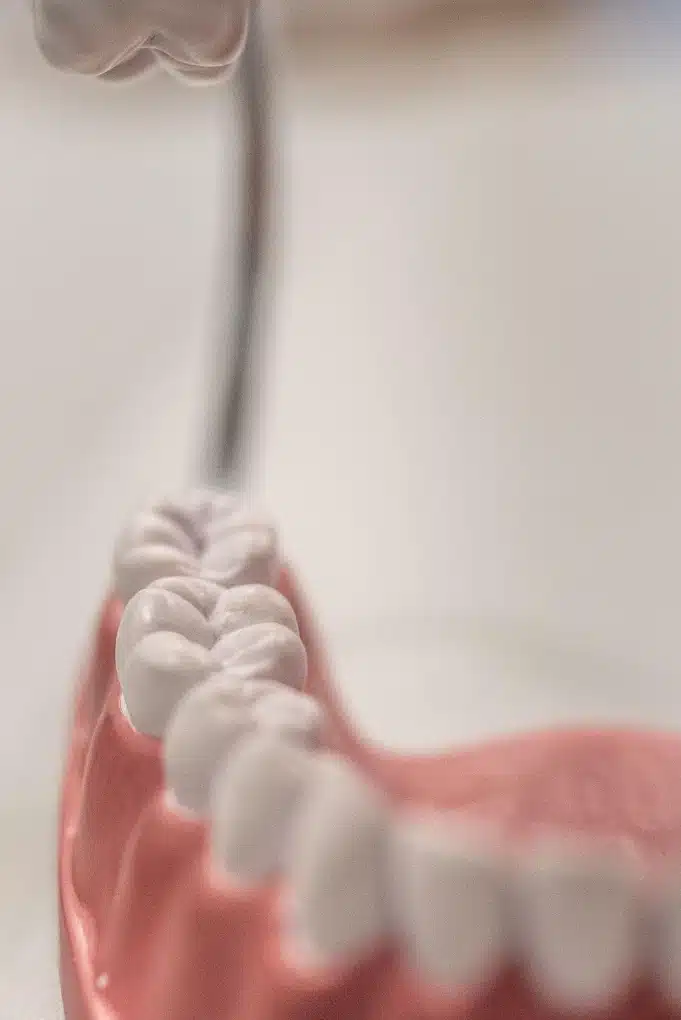 all-on-4 dental implants in troy, IL