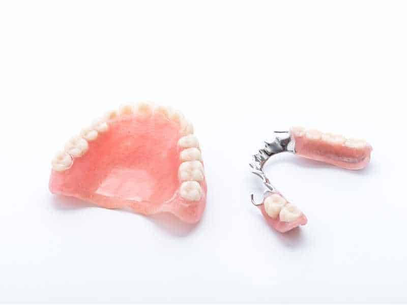 Example of affordable dentures and partial dentures in Troy, IL